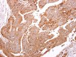 ARF3 Antibody in Immunohistochemistry (Paraffin) (IHC (P))