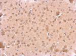 ARF3 Antibody in Immunohistochemistry (Paraffin) (IHC (P))