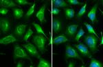 ARF5 Antibody in Immunocytochemistry (ICC/IF)