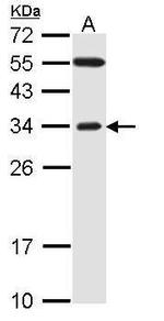 FBXO2 Antibody in Western Blot (WB)