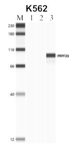 PRPF39 Antibody in RNA Immunoprecipitation (RIP)