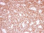 PRPF39 Antibody in Immunohistochemistry (Paraffin) (IHC (P))