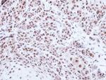 PRPF39 Antibody in Immunohistochemistry (Paraffin) (IHC (P))