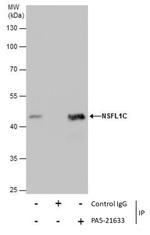 NSFL1C Antibody in Immunoprecipitation (IP)