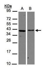 EMAP II Antibody in Western Blot (WB)