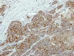 NR0B1 Antibody in Immunohistochemistry (Paraffin) (IHC (P))