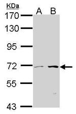 TPL2 Antibody in Western Blot (WB)