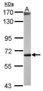 TPL2 Antibody in Western Blot (WB)