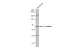 C1 inhibitor Antibody in Western Blot (WB)