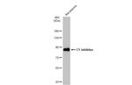 C1 inhibitor Antibody in Western Blot (WB)