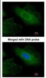 Radixin Antibody in Immunocytochemistry (ICC/IF)