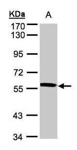 XPNPEP3 Antibody in Western Blot (WB)