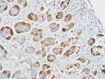 GSTA2 Antibody in Immunohistochemistry (Paraffin) (IHC (P))