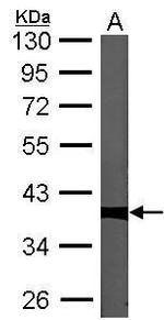 PP1 gamma Antibody in Western Blot (WB)