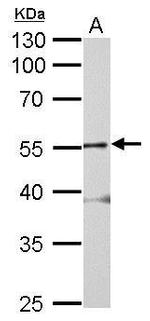 GLRA2 Antibody in Western Blot (WB)