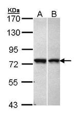 VPS51 Antibody in Western Blot (WB)