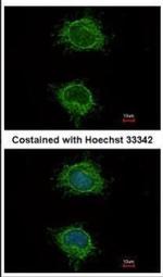 NDUFS4 Antibody in Immunocytochemistry (ICC/IF)