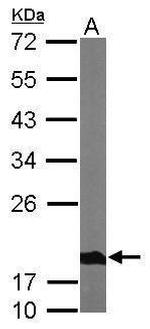 NDUFS4 Antibody in Western Blot (WB)