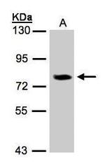 IL17RD Antibody in Western Blot (WB)