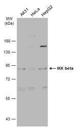 IKK beta Antibody in Western Blot (WB)