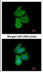 PFKL Antibody in Immunocytochemistry (ICC/IF)