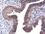 PFKL Antibody in Immunohistochemistry (Paraffin) (IHC (P))