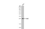 STAR Antibody in Western Blot (WB)