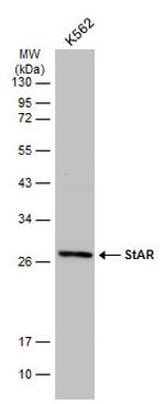 STAR Antibody in Western Blot (WB)