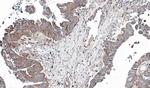 NT5C2 Antibody in Immunohistochemistry (Paraffin) (IHC (P))