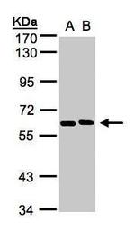 NT5C2 Antibody in Western Blot (WB)