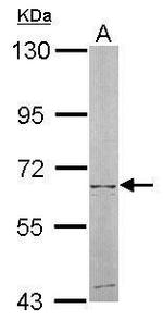 NT5C2 Antibody in Western Blot (WB)