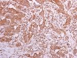 TCP-1 theta Antibody in Immunohistochemistry (Paraffin) (IHC (P))