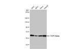 TCP-1 theta Antibody in Western Blot (WB)