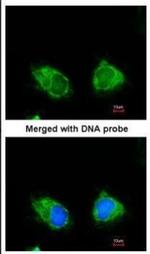 INPP1 Antibody in Immunocytochemistry (ICC/IF)