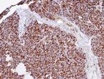 INPP1 Antibody in Immunohistochemistry (Paraffin) (IHC (P))