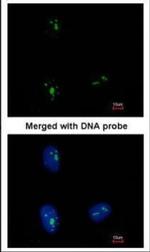 KRR1 Antibody in Immunocytochemistry (ICC/IF)