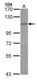 MYBPC2 Antibody in Western Blot (WB)