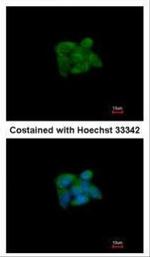 SUOX Antibody in Immunocytochemistry (ICC/IF)