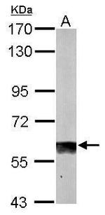 SUOX Antibody in Western Blot (WB)