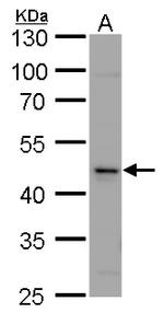 Calsequestrin 2 Antibody in Western Blot (WB)