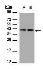 TBCC Antibody in Western Blot (WB)