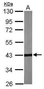 TBCC Antibody in Western Blot (WB)