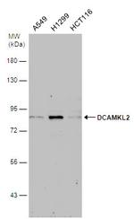 DCAMKL2 Antibody in Western Blot (WB)