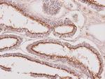 GALNT7 Antibody in Immunohistochemistry (Paraffin) (IHC (P))