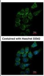 ST3GAL1 Antibody in Immunocytochemistry (ICC/IF)