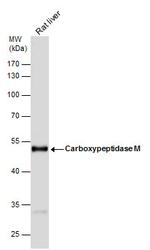 Carboxypeptidase M Antibody in Western Blot (WB)