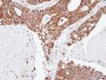 ERLIN2 Antibody in Immunohistochemistry (Paraffin) (IHC (P))