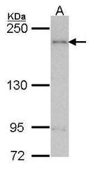 ARAP1 Antibody in Western Blot (WB)