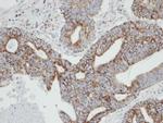 RAB2A Antibody in Immunohistochemistry (Paraffin) (IHC (P))