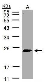 RAB2A Antibody in Western Blot (WB)